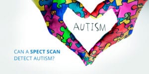 Autism Study SPECT Scan