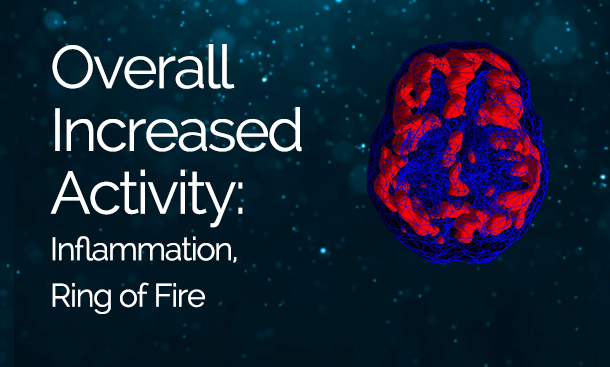 Overall Increased Activity: Inflammation, Ring of Fire