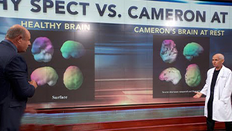 Dr. Amen Analyzes Brain Scans Of 21-Year-Old With Anger And Drug Issues