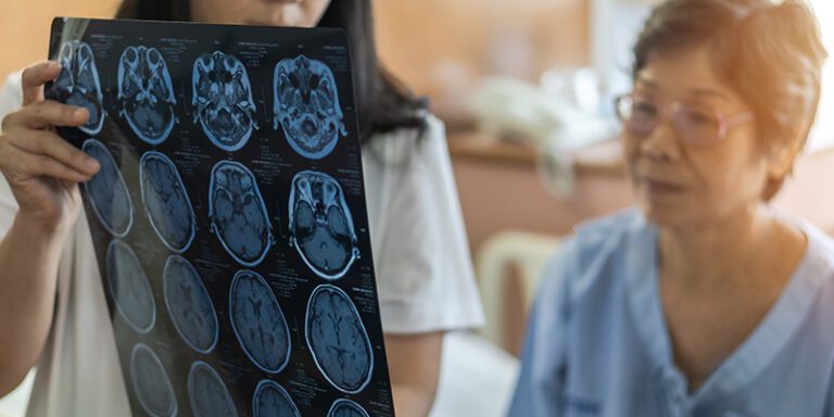 Brain Imaging: Functional MRI vs. SPECT Scans—What’s the Difference ...