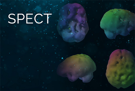 SPECT in Clinical Practice