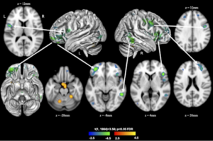 how negative thinking shrinks your brain
