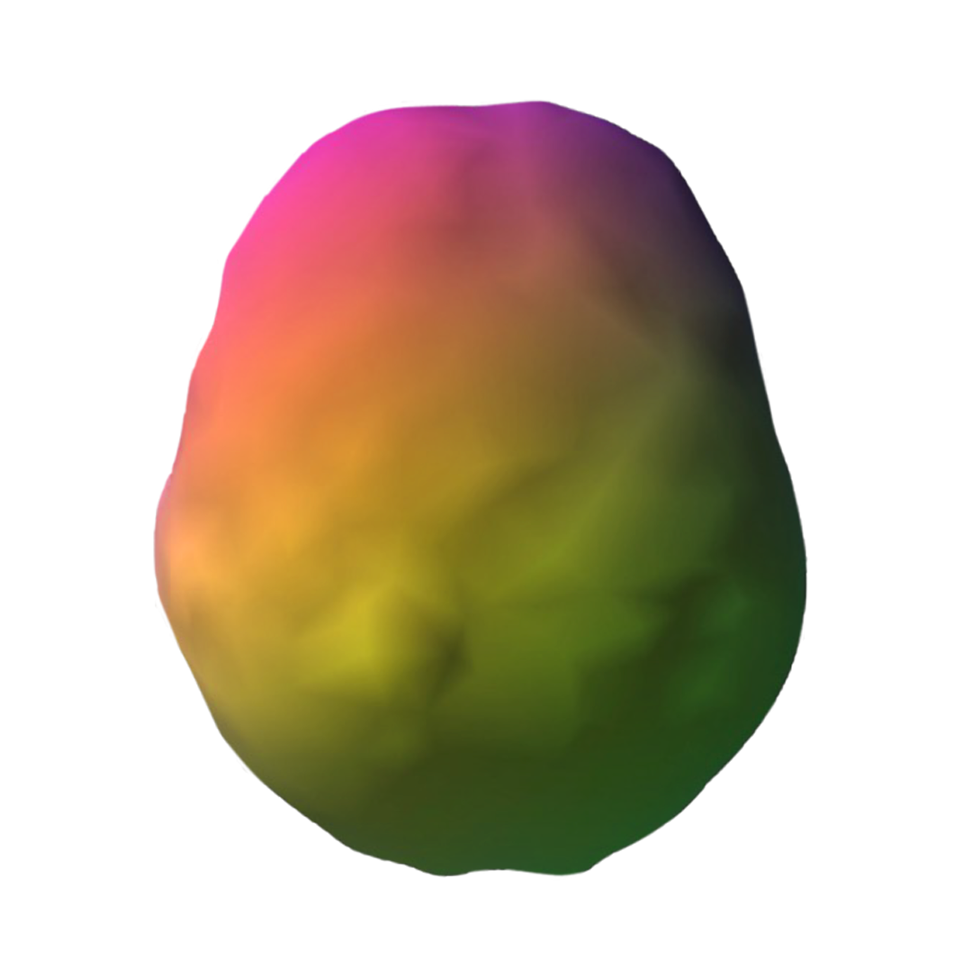 Healthy SPECT scan