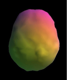 Healthy brain SPECT scan showing smooth, full, even surface activity