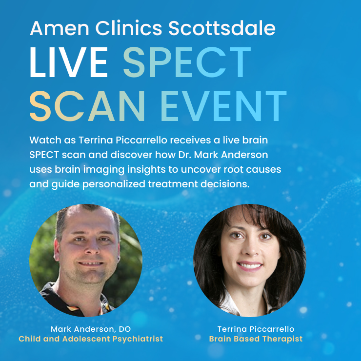 Live SPECT Scan Event